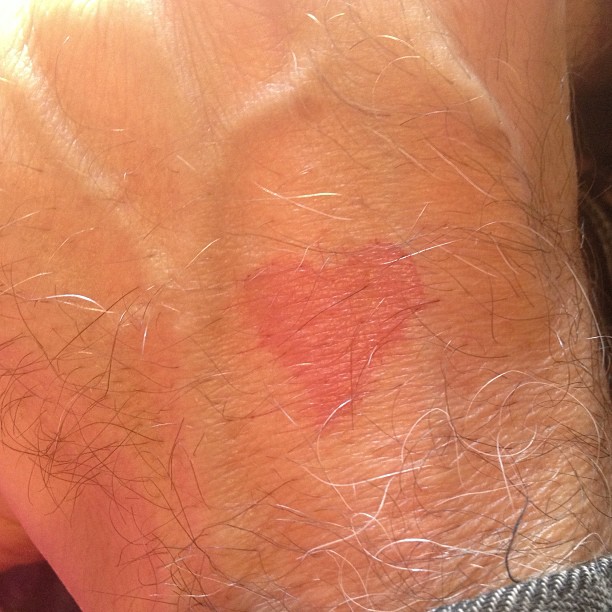 Corazón rojo dibujado sobre la piel de una muñeca
