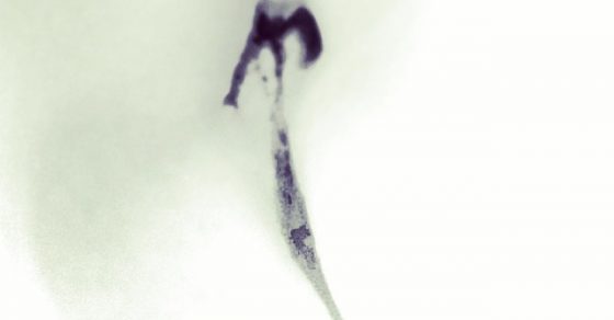 Roser Amills Foto Misteriosa Abstracta