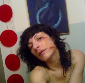 Roser Amills Accidente Bicicleta Golpes En La Cara Mercromina Cicatrices