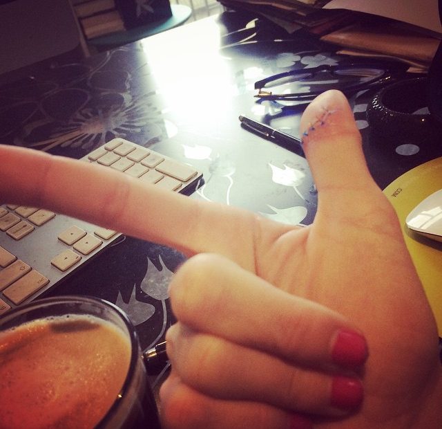 Dedo De Roser Amills Accidente