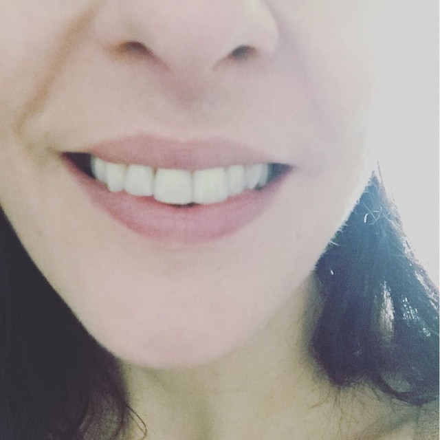 Primer plano de una sonrisa con labios rosados y dientes blancos