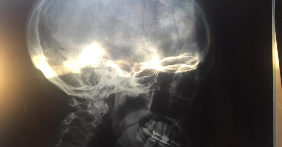 Roser Amills radiografia