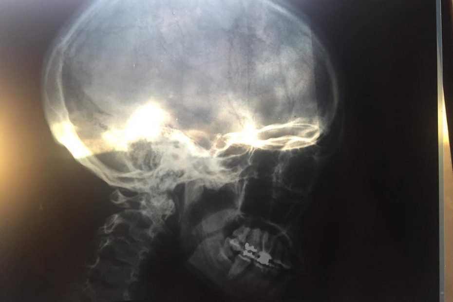 Roser Amills radiografia