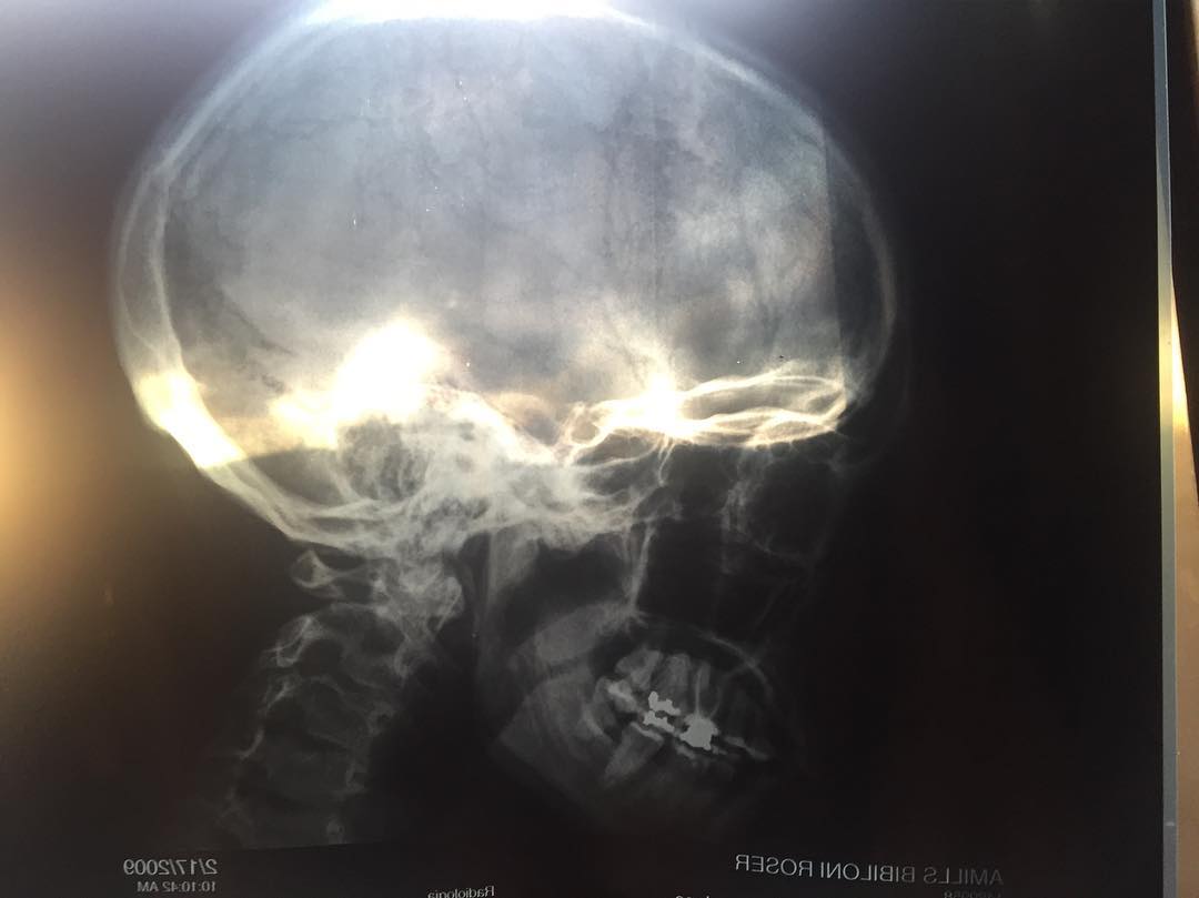 Roser Amills radiografia