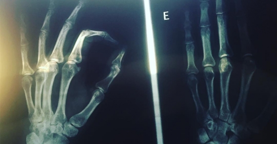 radiografias de roser amills