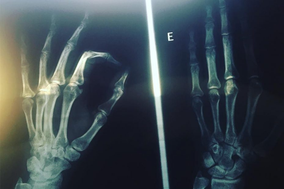 radiografias de roser amills