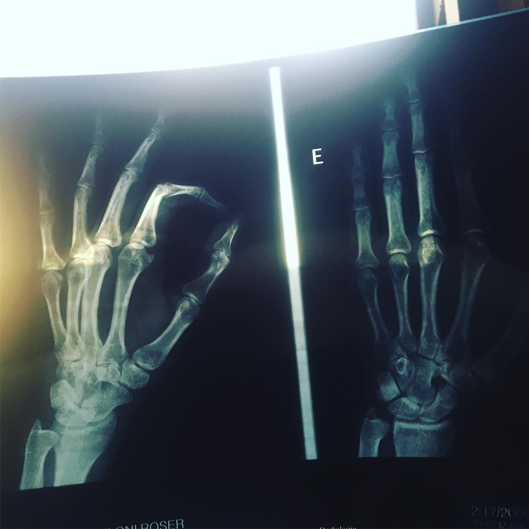 radiografias de roser amills