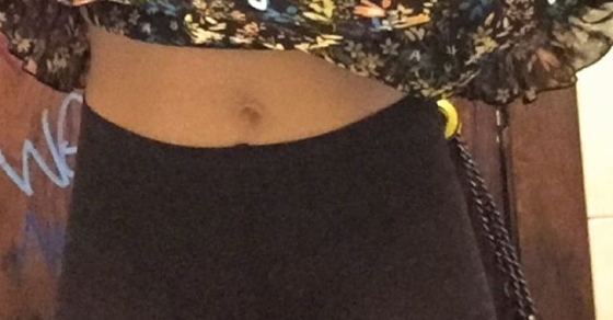 ombligo de roser amills