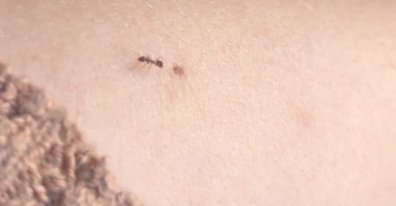 Hormiga sobre el brazo de Roser Amills