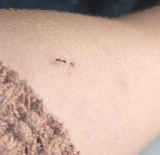 Hormiga sobre el brazo de Roser Amills