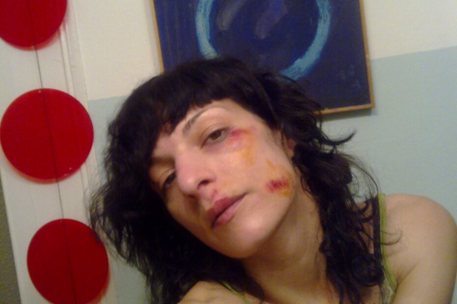 Autorretrato de Roser Amills con golpes en la cara, 17 de febrero de 2009